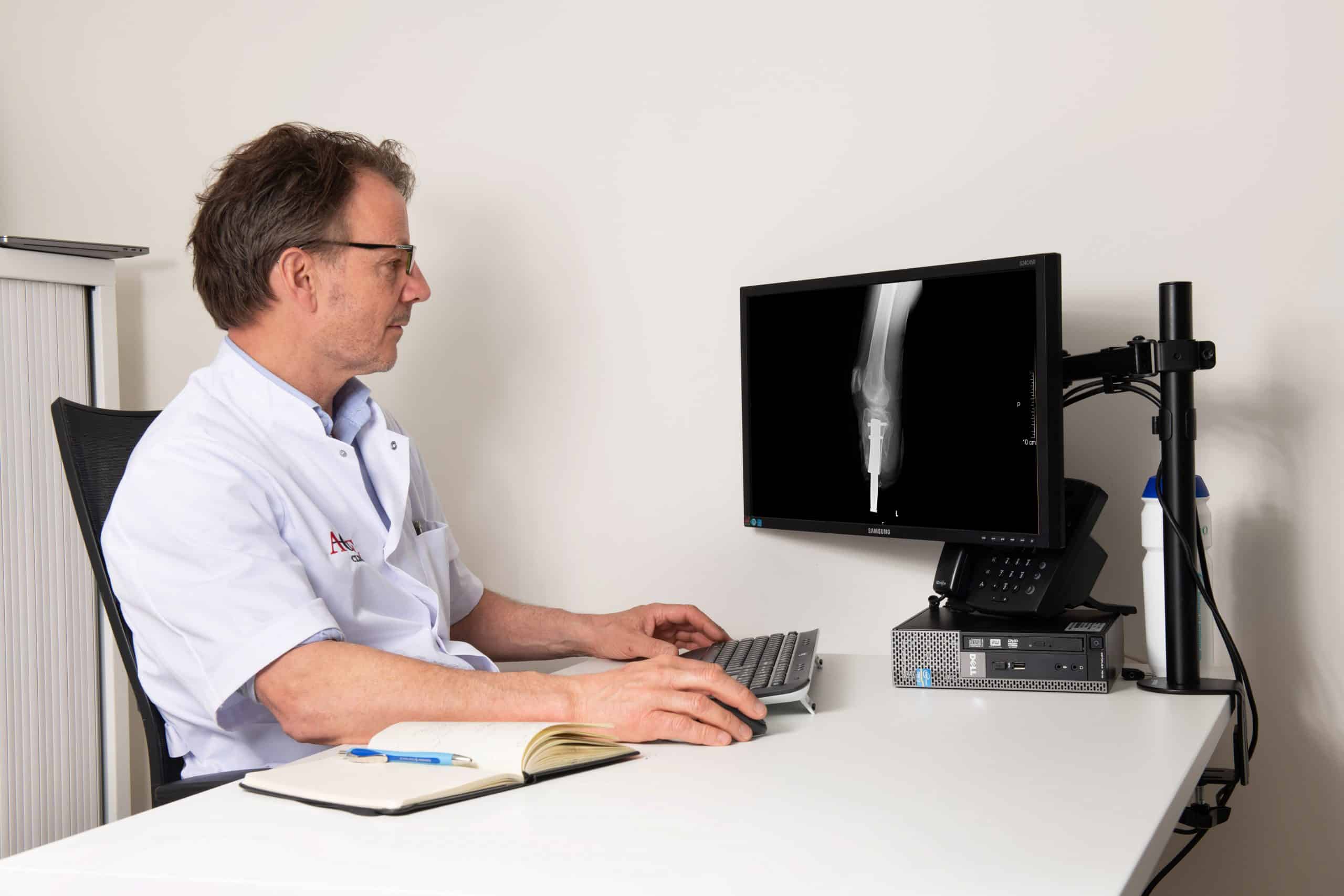 stomprevisie bij AOFE Clinics - Stump prosthesis revision at AOFE clinics - Prosthesis arm or legs