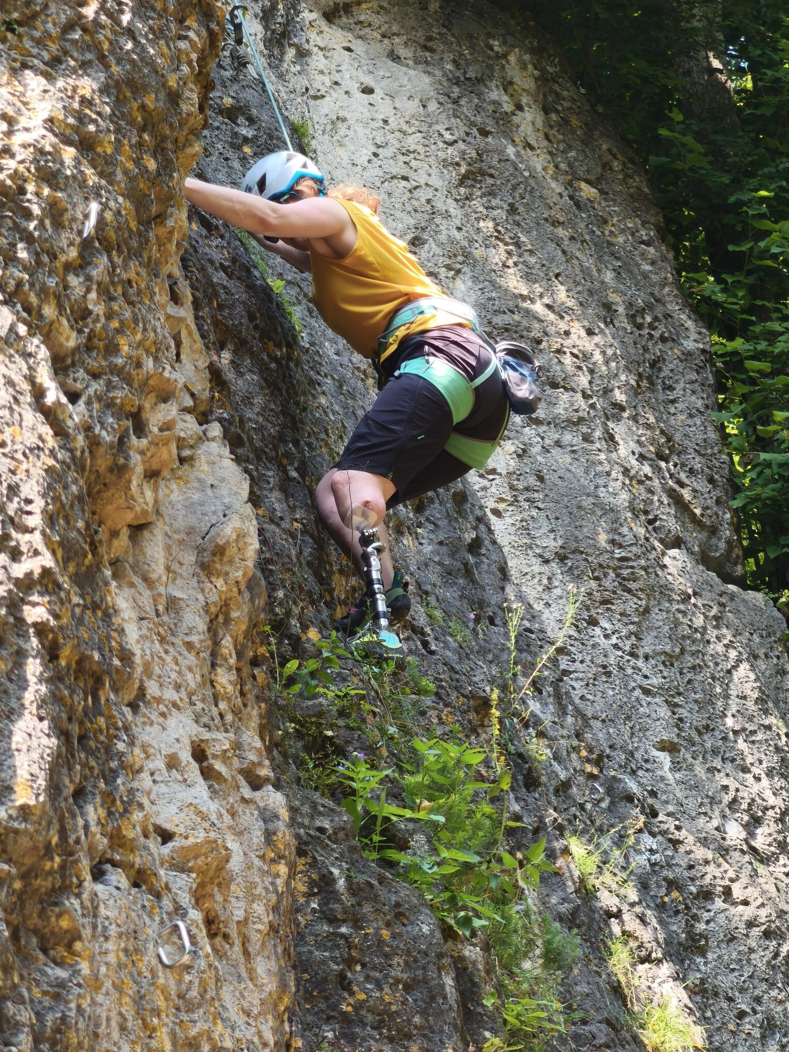 Climbing a mountain with osseointegration