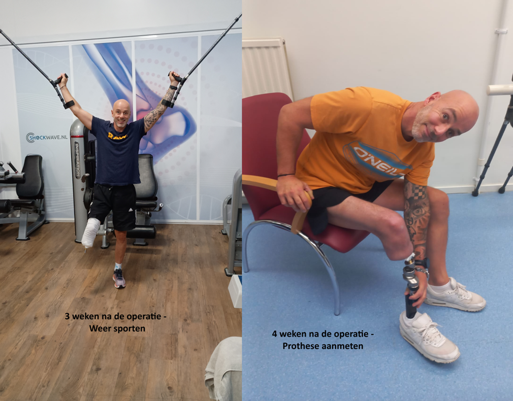 verhaal van patien rick bij AOFE clinics